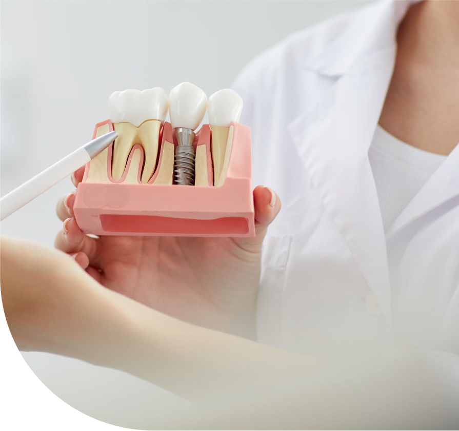 dental implants marketing