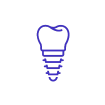 dental implants