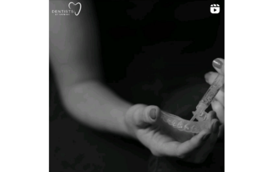 marketing of clear aligners