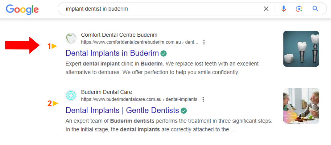 dentist-in-buderim -marketing result