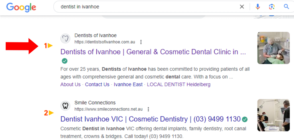 dentist-in-ivanhoe-Dental marketing -result