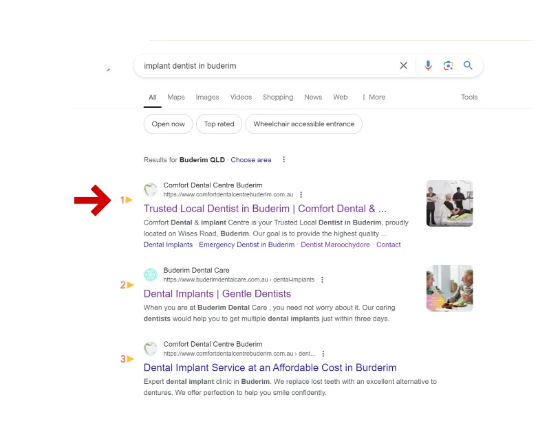 implant-dentist-in-buderim