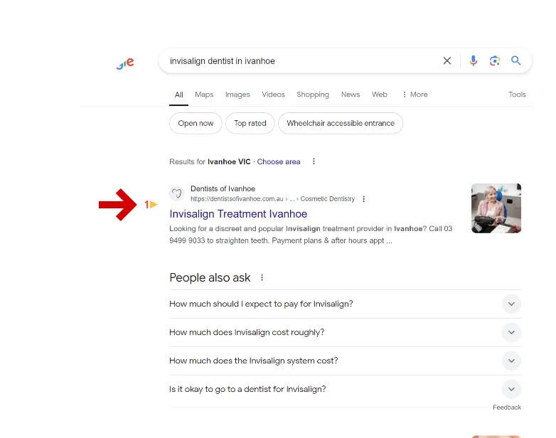 invisalign-dentist-in-ivanhoe